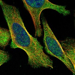 TBC1D8B Antibody, Novus Biologicals:Antibodies:Primary Antibodies